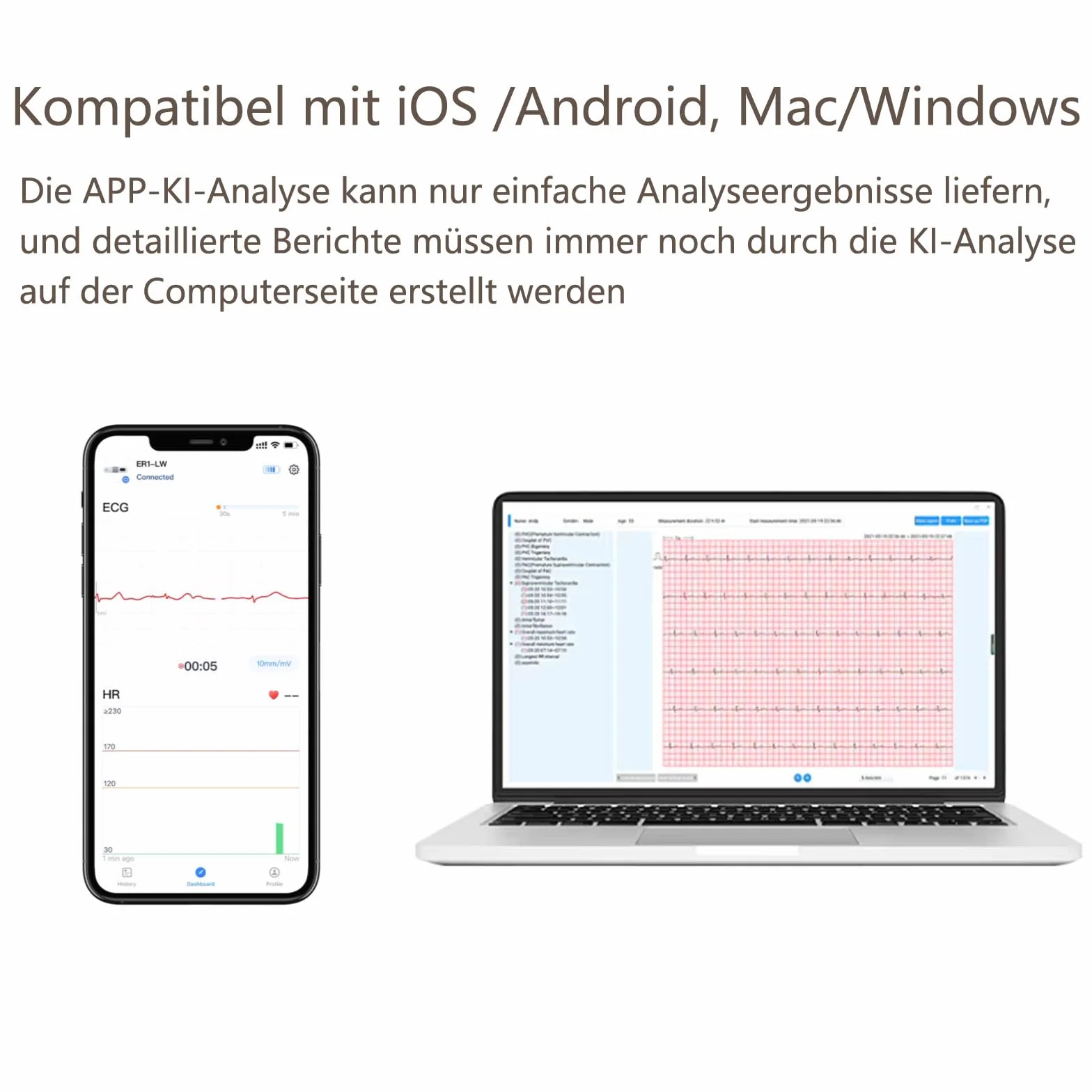 Wellue ECG 24 heures à domicile,Analyse AI,Enregistreur d'événements ECG,Compatible Ios & Android, Mac & Windows, temps de surveillance de 5 min à 24 h