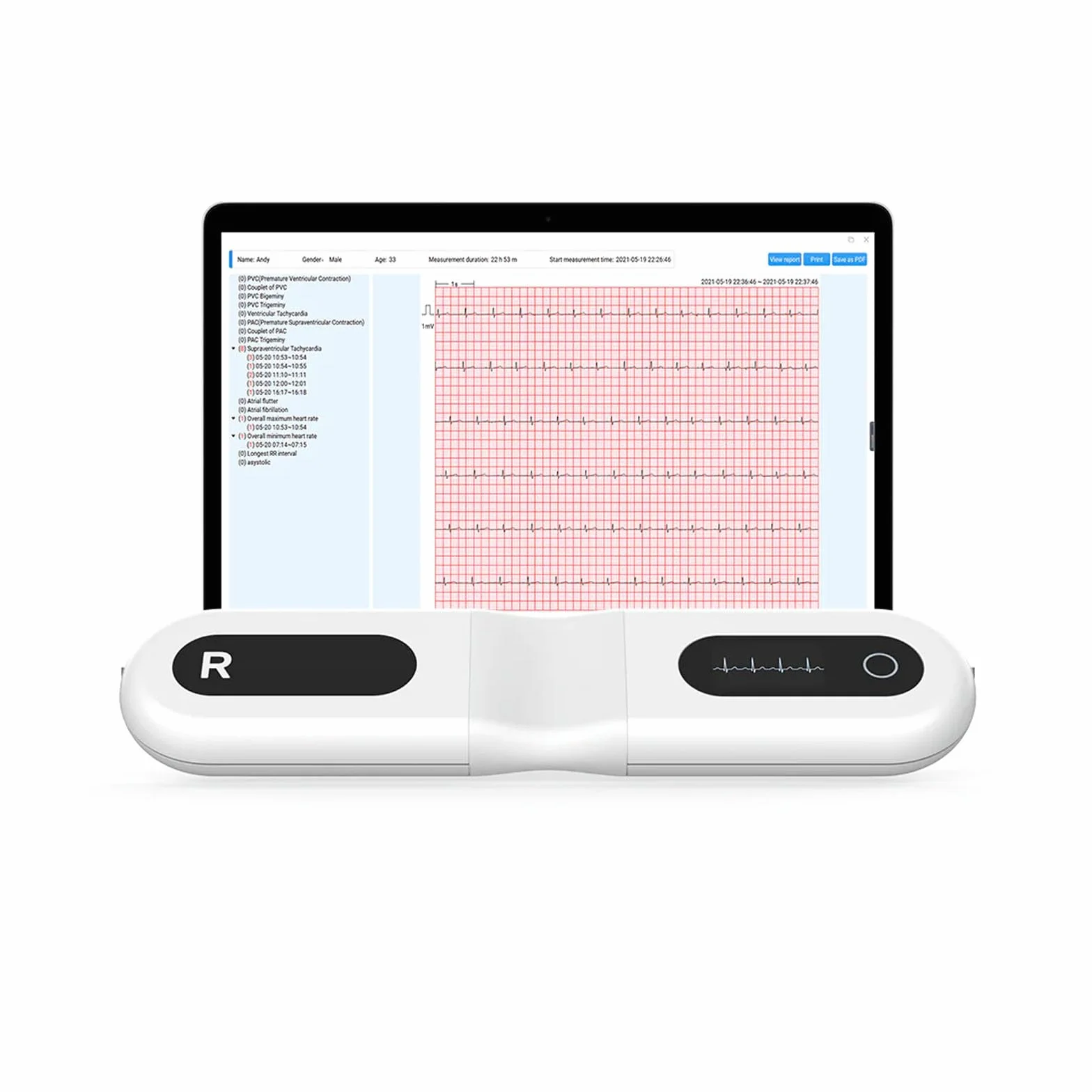 Wellue ECG 24 heures à domicile,Analyse AI,Enregistreur d'événements ECG,Compatible Ios & Android, Mac & Windows, temps de surveillance de 5 min à 24 h