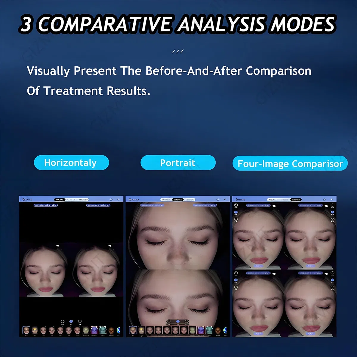 Analyseur de Peau Professionnel, Appareil d'analyse cutanée IA avec caméra HD 30 MP, Diagnostic Professionnel pour l'évaluation des Soins de la Peau, Stockage des rapports dans Le Cloud