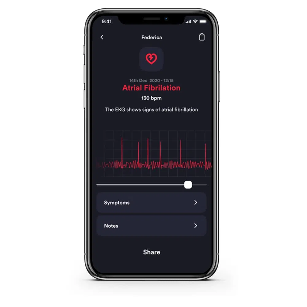 Cardionica Moniteur ECG Portable Professionnel À Canal Unique | Électrocardiographe Portable Pour Électrocardiogramme Professionnel | Électrocardiogramme Portable et Compteur Fibrillation Atriale | Diagnostic cardiaque en 1 minute – Détection clinique de
