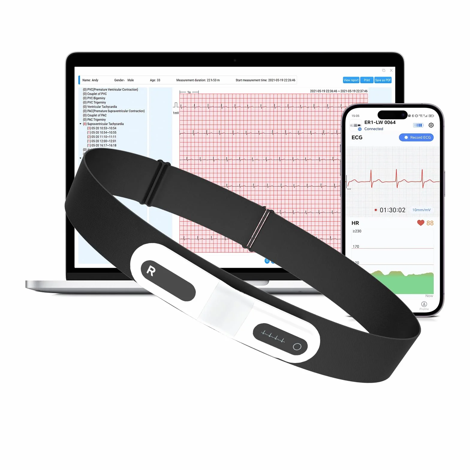 CheckMe ER1-LW Moniteur ECG Portable 72 Heures avec Analyse ECG AI, Fonction Marqueur D'événement ECG, App & PC-software, Compatible avec Les Électrodes à pression de 4 mm