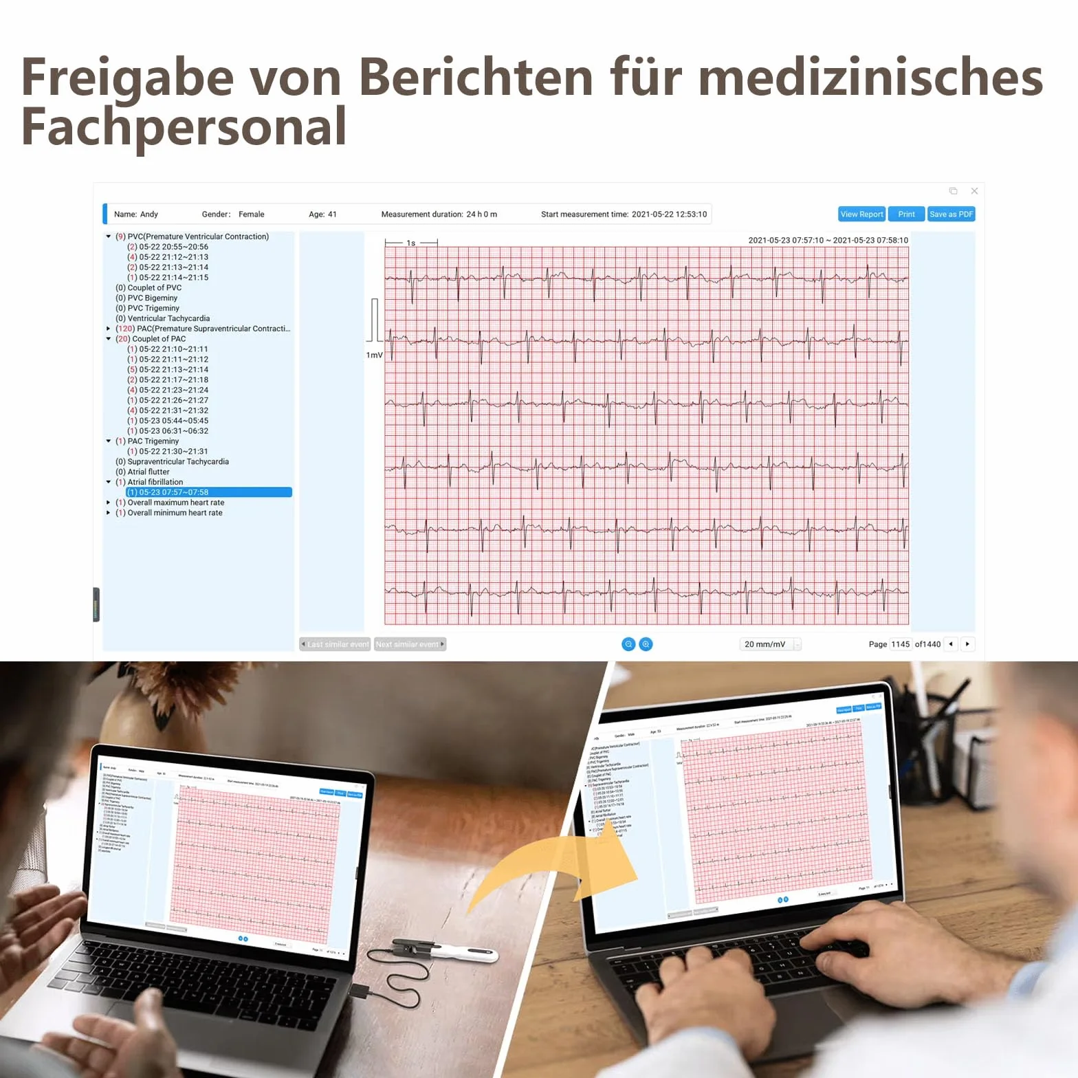 Wellue ECG 24 heures à domicile,Analyse AI,Enregistreur d'événements ECG,Compatible Ios & Android, Mac & Windows, temps de surveillance de 5 min à 24 h