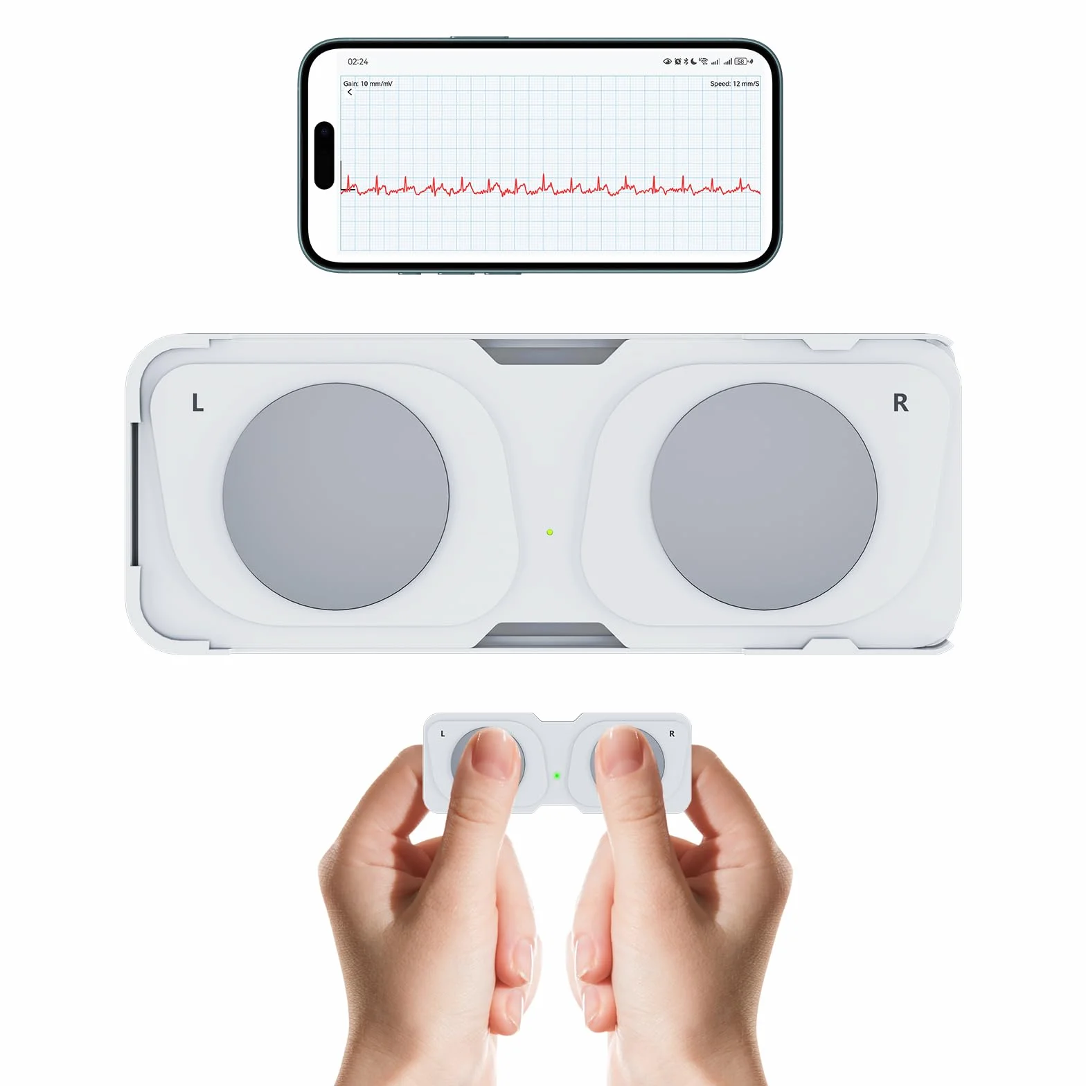 Moniteur ECG mobile, appareil ECG personnel, détecte la fibrillation auriculaire, la bradycardie ou la tachycardie en 30 secondes, moniteur de fréquence cardiaque, application pour iOS/Android