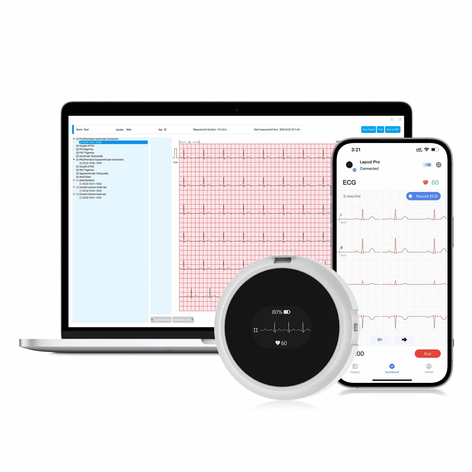 Wellue LP12 ECG portable 12 dérivations avec écran OLED, enregistrement de l'ECG en temps réel sur 24 heures, rapports AI ECG détaillés, marqueurs d'événements, Support pour Smartphone APP et PC
